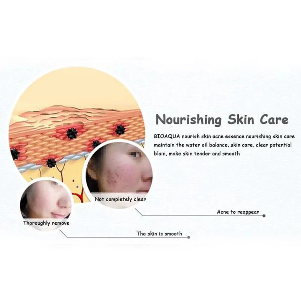 BIOAQUA Acne Removing Skin Rejuvenating Essence - 30ml - Image 7