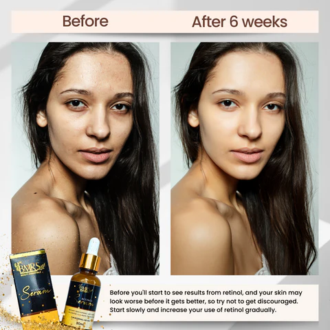 BMRS Retinol Serum - 30ml - Image 5