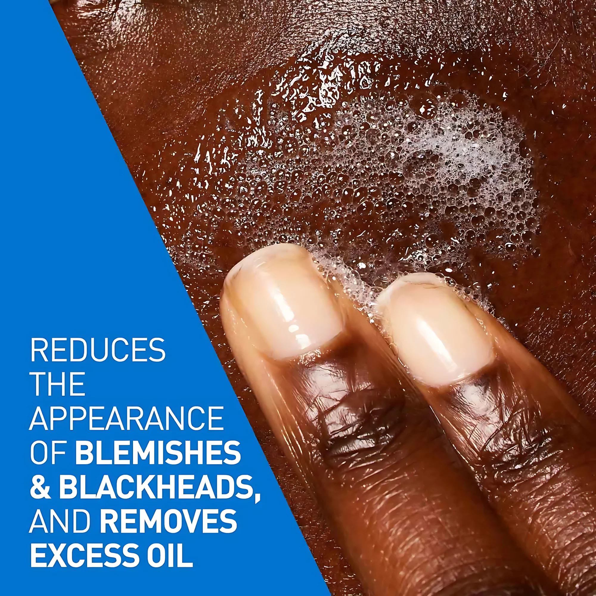 CeraVe Blemish Control Cleanser – 236ml - Image 10
