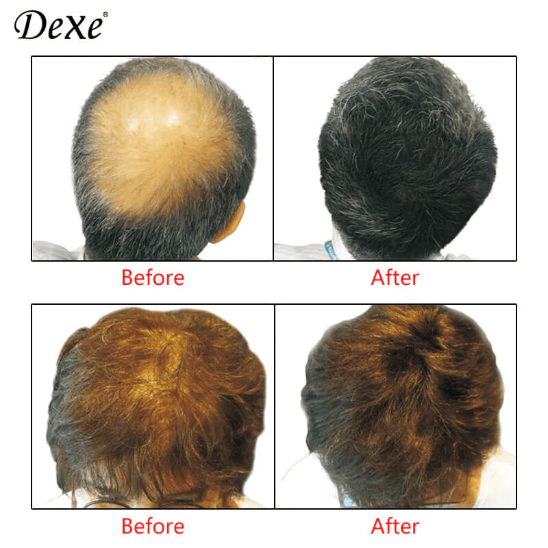 Dexe Hair Building Fibers Dark Brown No.2 - 22g - Image 2
