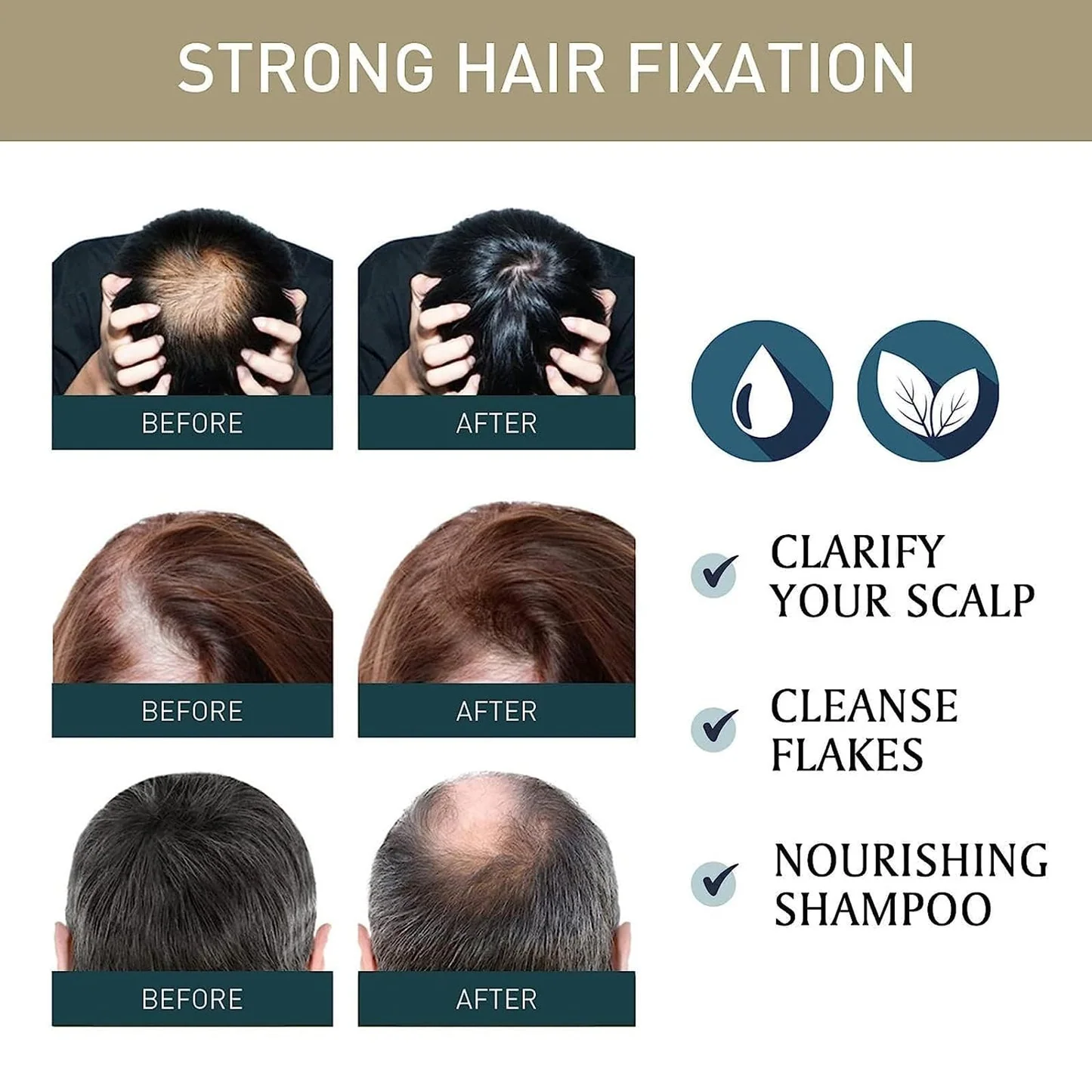 Diyating Hair Growth Sakura Japanese Shampoo & Conditioner Set - 300ml × 2Pcs - Image 6