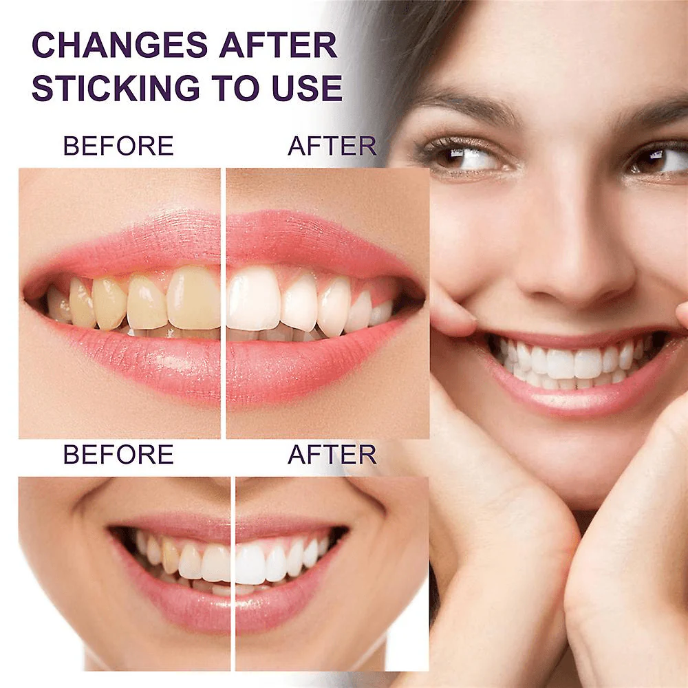 Eelhoe Purple Whitening Toothpaste Yellow Teeth Stains Removal - 50ml - Image 2