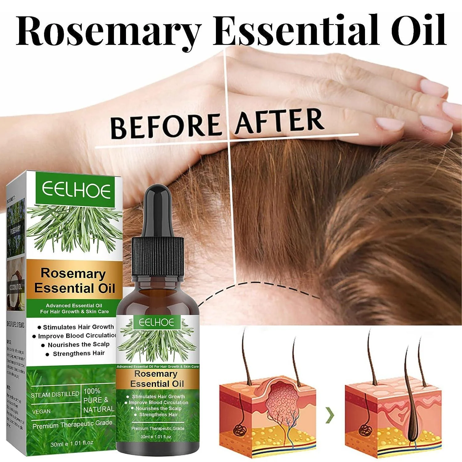 EELHOE Rosemary Oil for Hair Growth - Image 2
