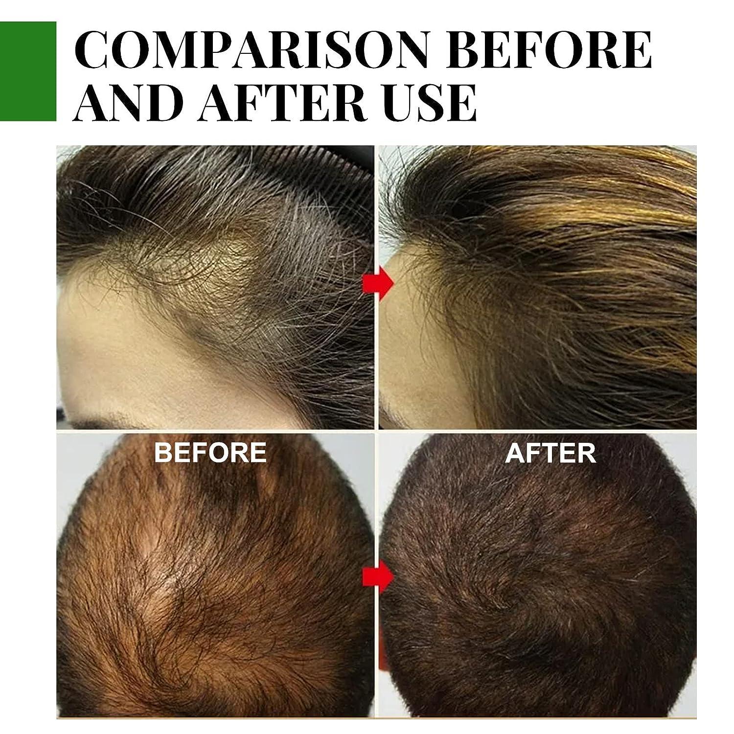 EELHOE Rosemary Oil for Hair Growth - Image 6