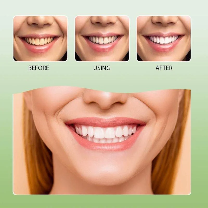 Face U Japan Technology Whitening Toothpaste With Baking Soda - 180g - Image 6