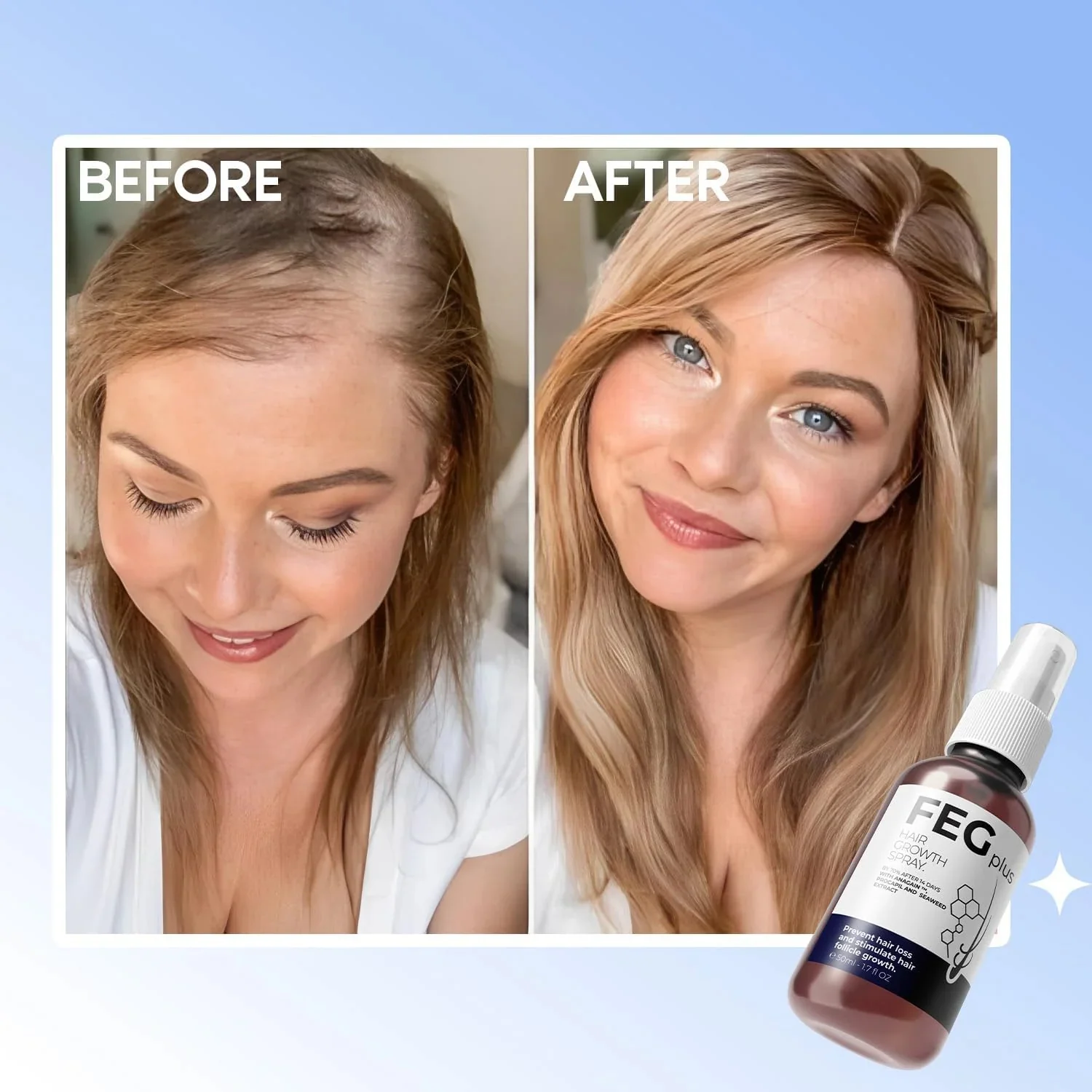 FEG Plus Hair Growth Spray – 50ml - Image 4