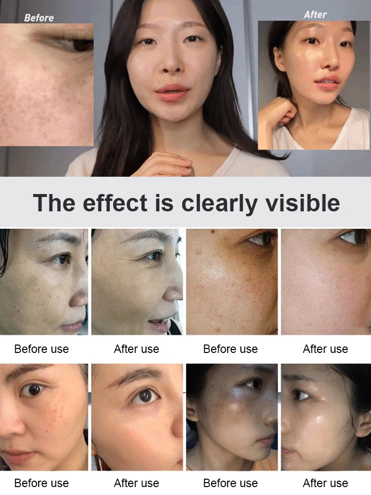 Hanxi Whitening & Repairing Essence Serum - 30ml - Image 5