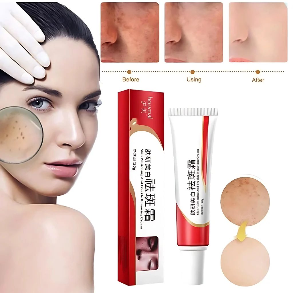 Houmai Skin Whitening & Freckle Removing Cream – 20g - Image 2