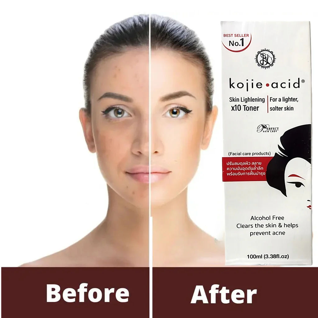 Kojie Acid Skin Brightening X10 Toner - 100ml - Image 2