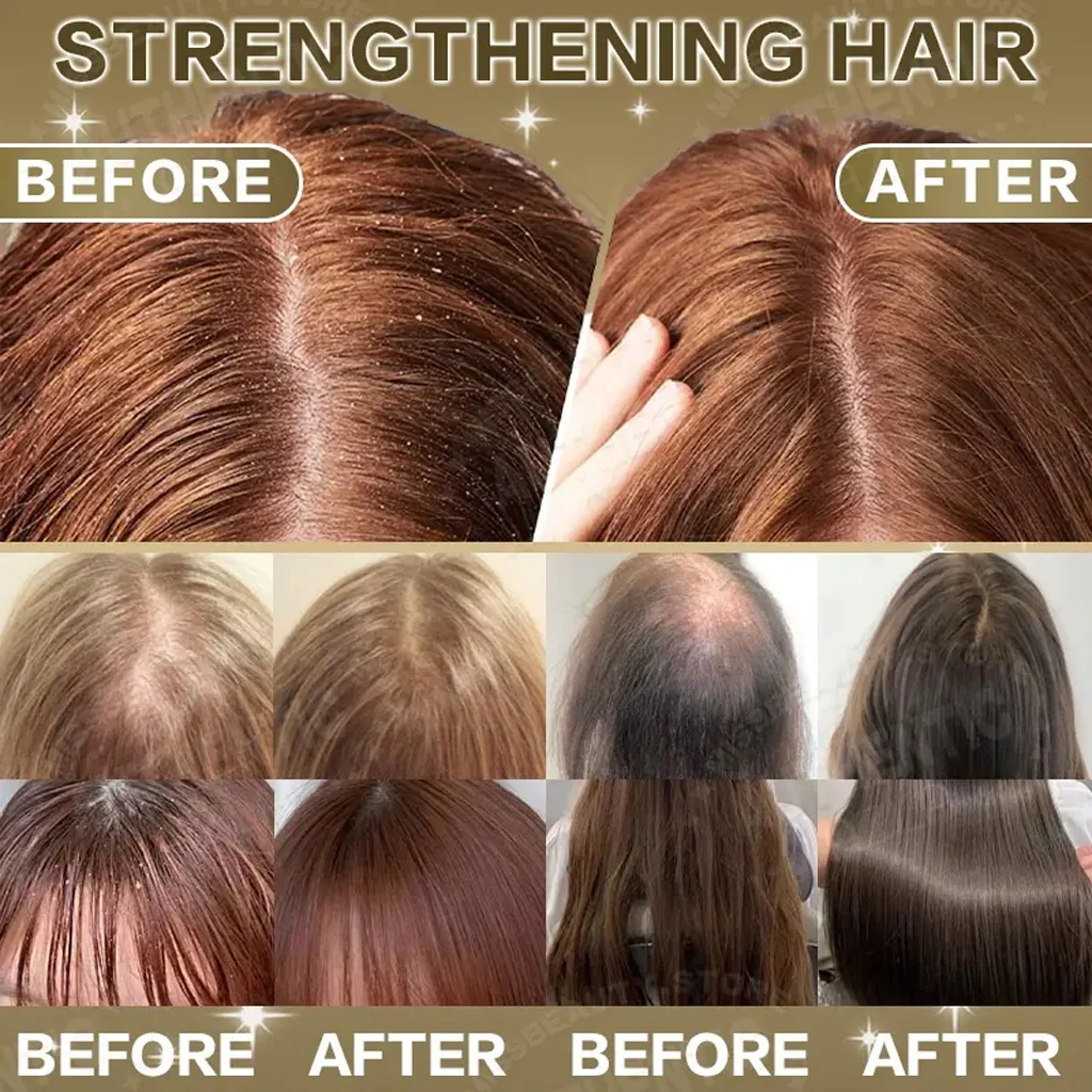 KORMESIC Hair Growth & Strengthening Combo - Image 15