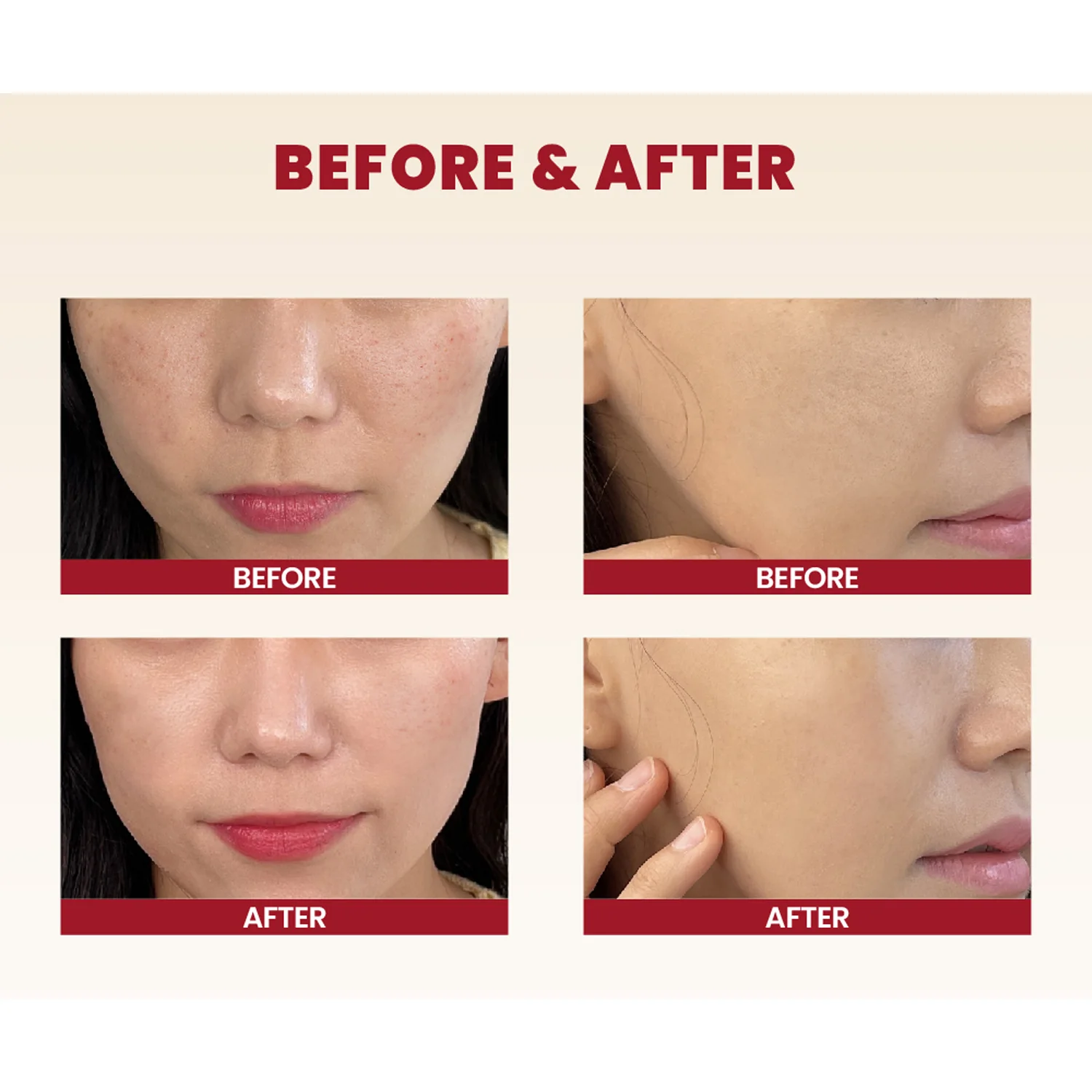 K-SECRET SEOUL 1988 Cream (Snail Mucin 93% + Rice) - 100ml - Image 7