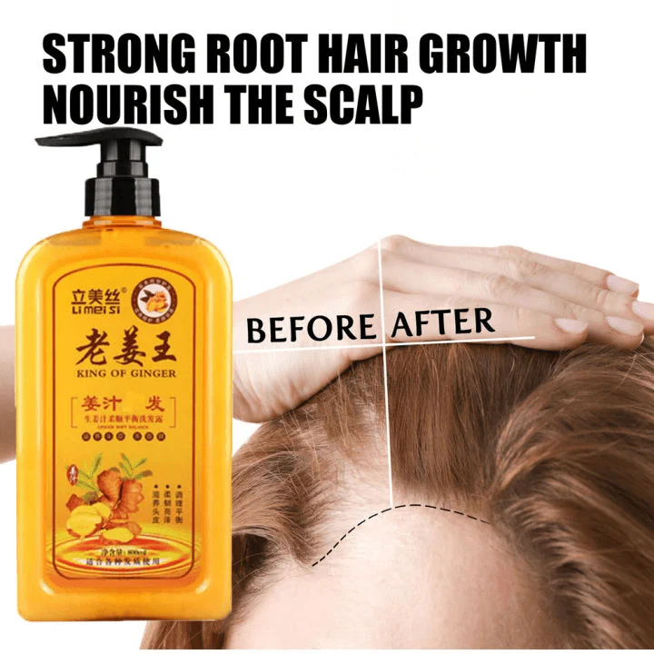 Li Mei Si King Of Ginger Conditioner - 500ml - Image 2