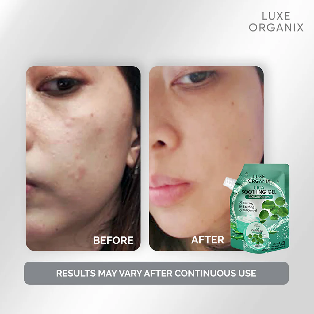 Luxe Organix Cica Soothing Gel – 100ml - Image 3