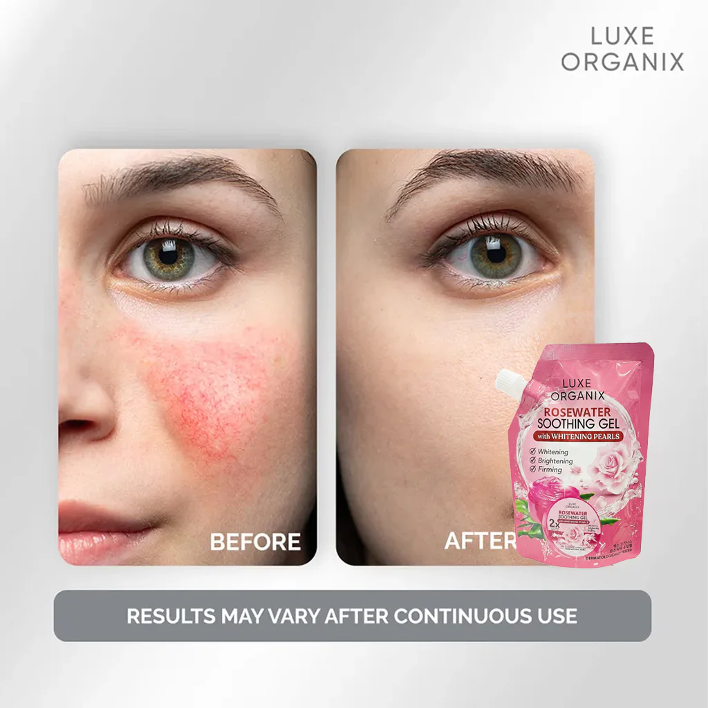 Luxe Organix Rosewater Soothing Gel with Whitening Pearls – 100ml - Image 6