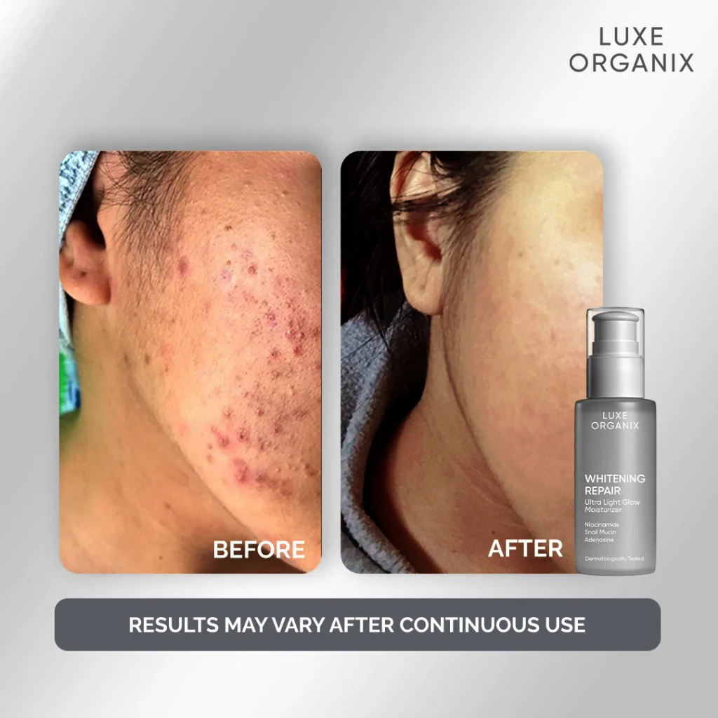 Luxe Organix Whitening Repair Ultra Light Glow Moisturizer – 80ml - Image 11