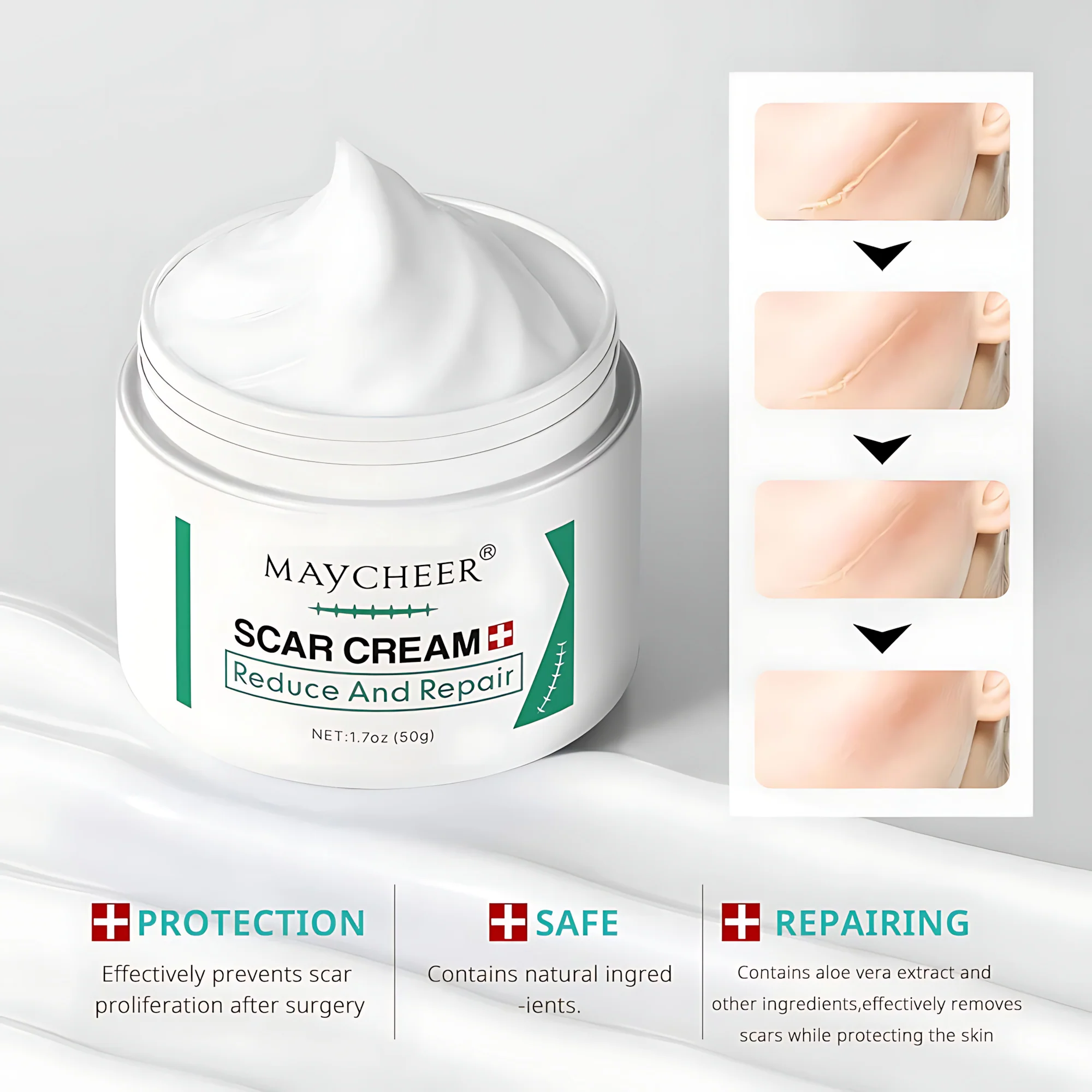MAYCHEER Scar Cream – Advanced Scar Reduction & Skin Repair (50g) - Image 10