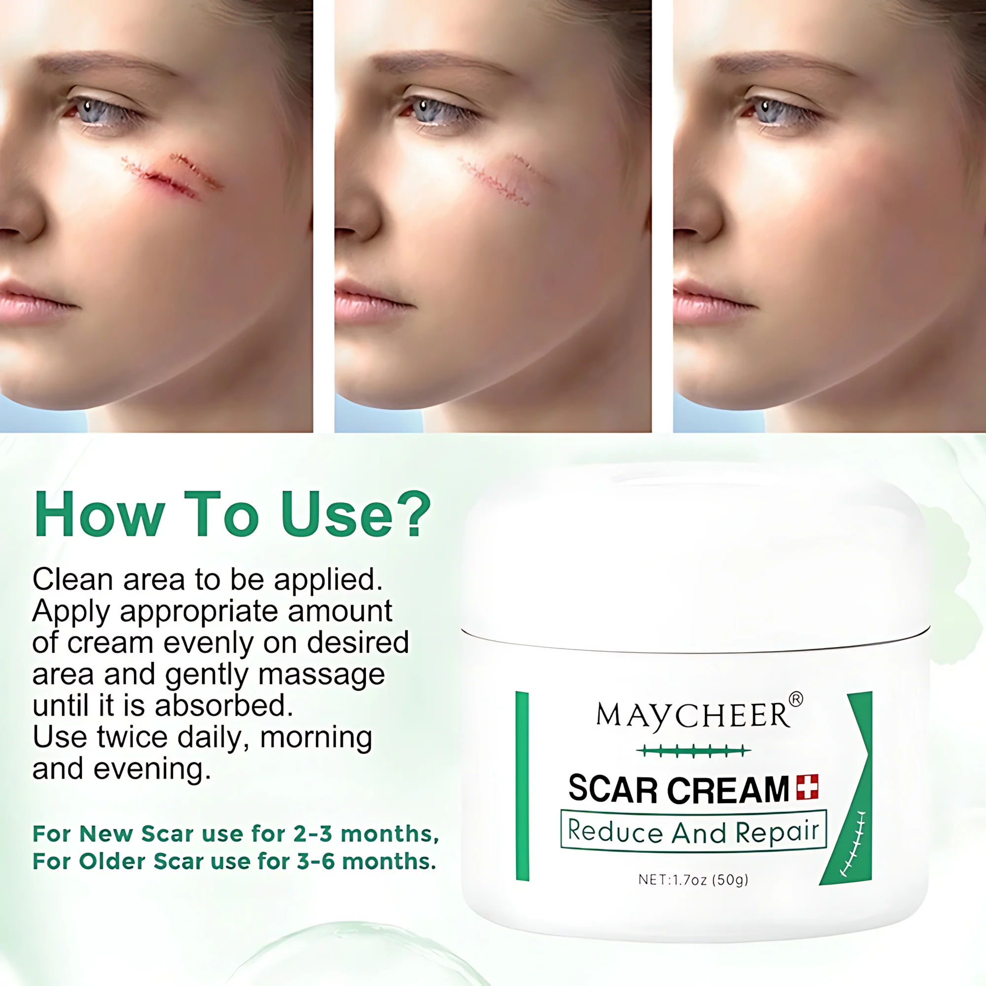 MAYCHEER Scar Cream – Advanced Scar Reduction & Skin Repair (50g) - Image 2