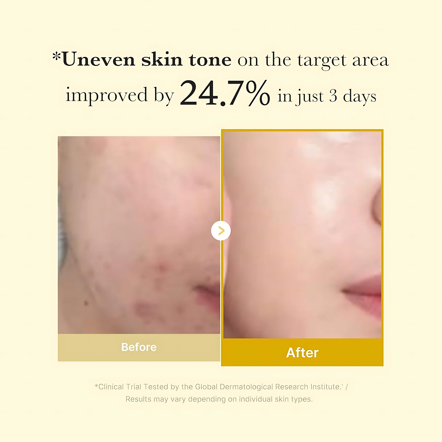 Medicube Kojic Acid Turmeric Night Wrapping Mask – 75ml - Image 4
