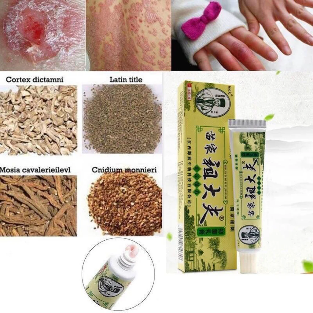 Miaojia Zudaifu Antibacterial Cream – Authentic Miao Formula (15g) - Image 6