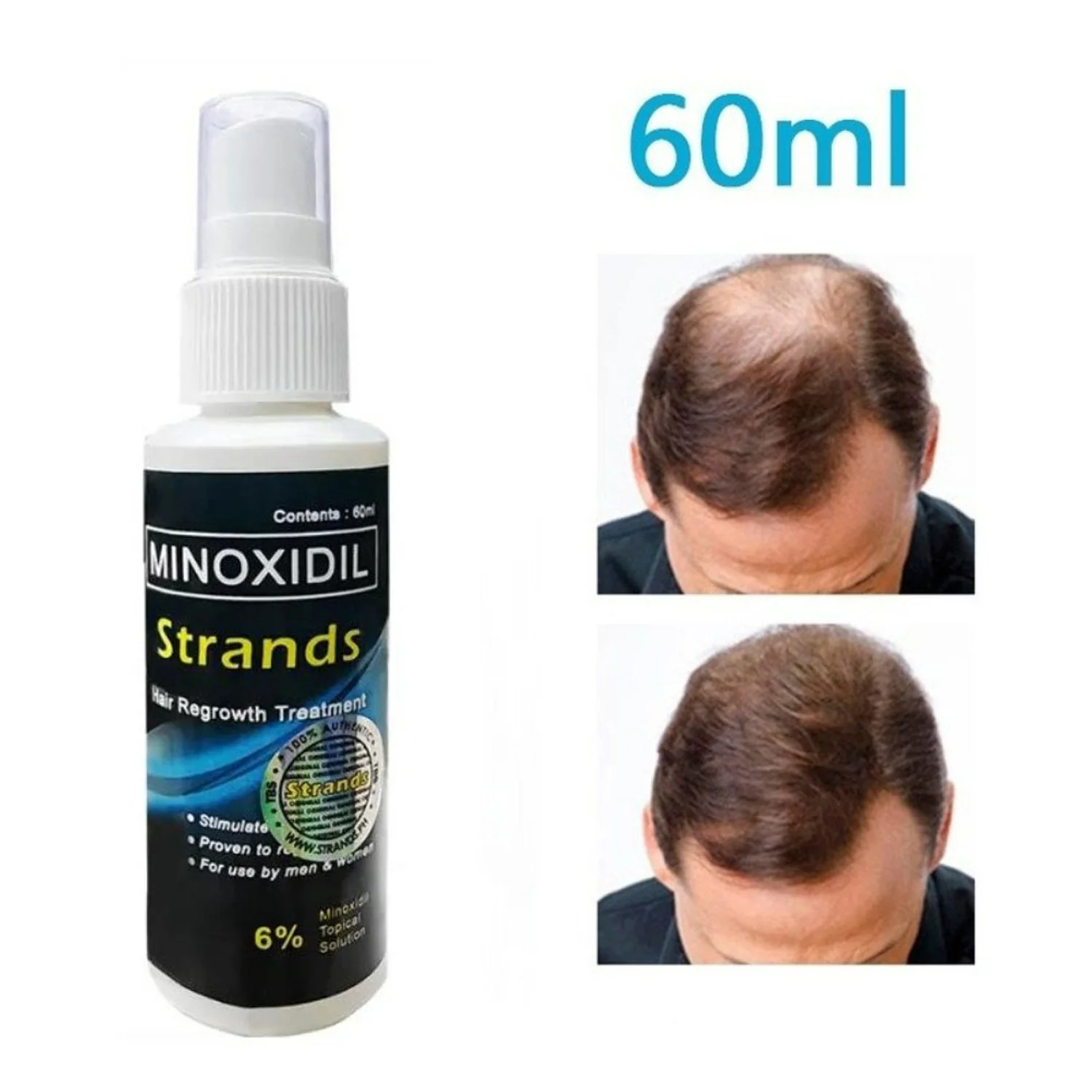 Minoxidil Strands 6% Hair Regrowth Treatment - 60ml - Image 2