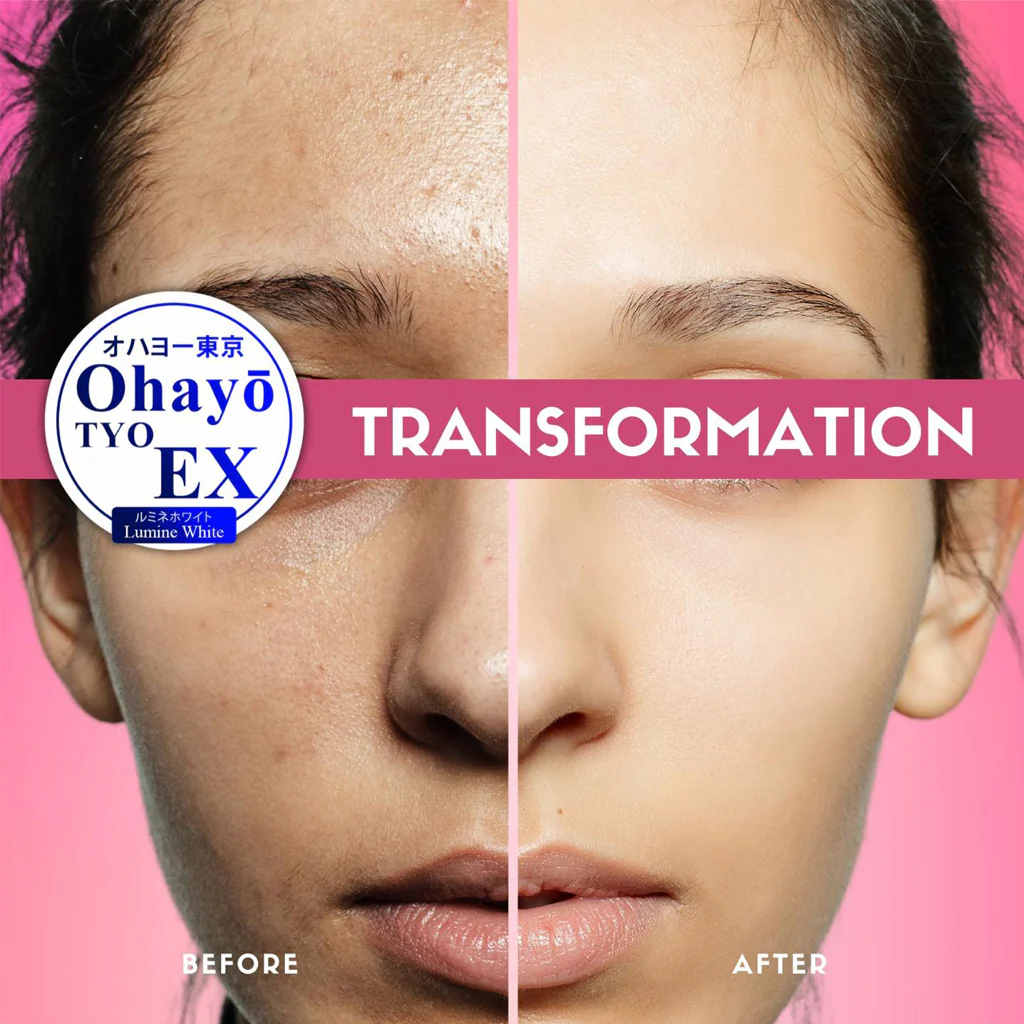 Ohayo Tyo EX Lumine White Glutathione 700mg – 60 Cap - Image 3