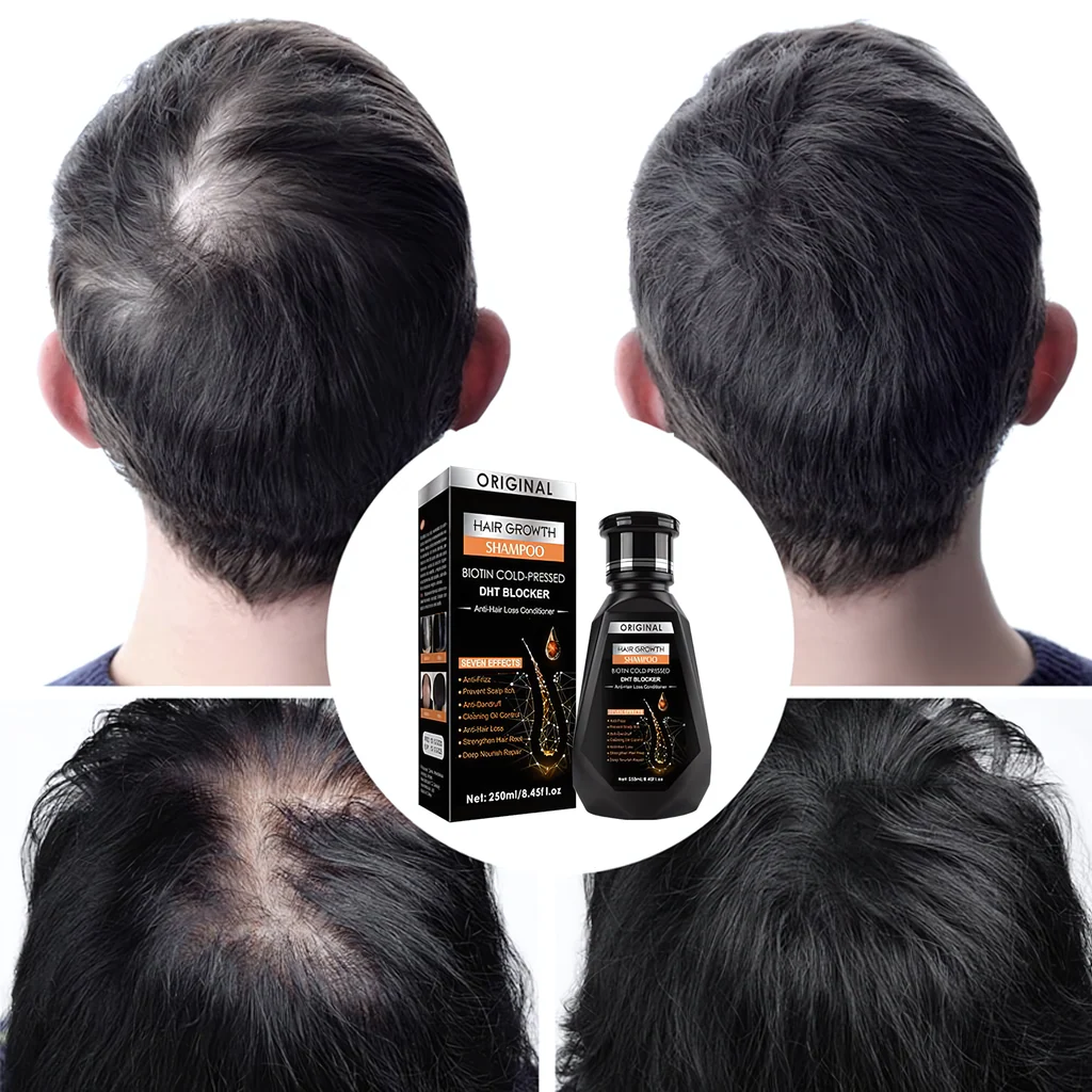 Original Biotin Cold-Pressed DHT BLOCKER Hair Growth Shampoo  Formbo- 250ML - Image 6