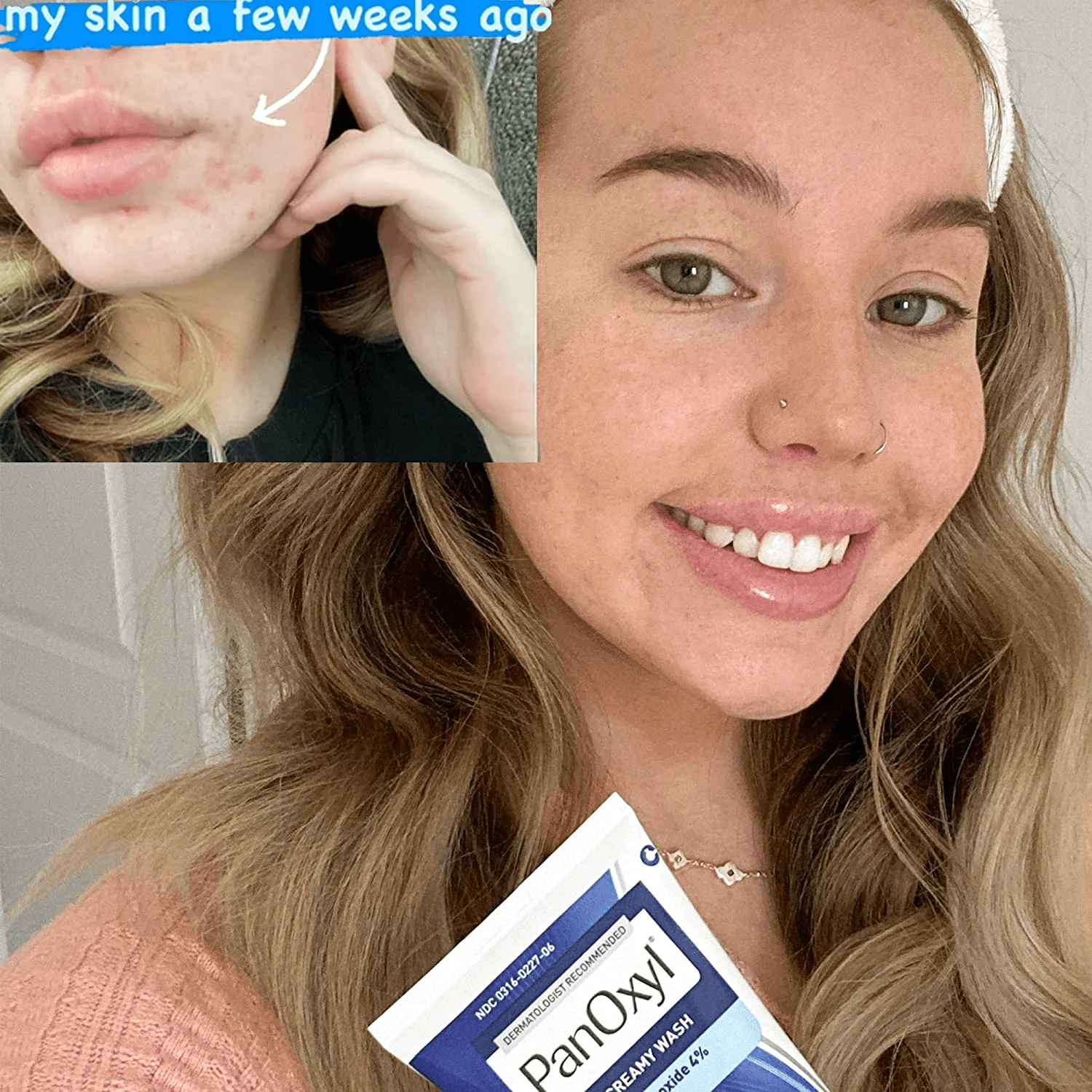 PanOxyl Acne Creamy Wash Benzoyl Peroxide 4% Daily Control - 170g - Image 3