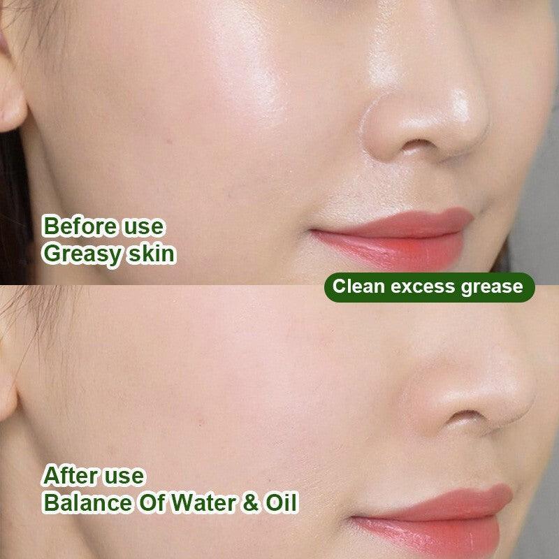 TEN TWENTY Green Mask Stick – Green Tea Oil Control Cleansing Solid Mask - Image 15