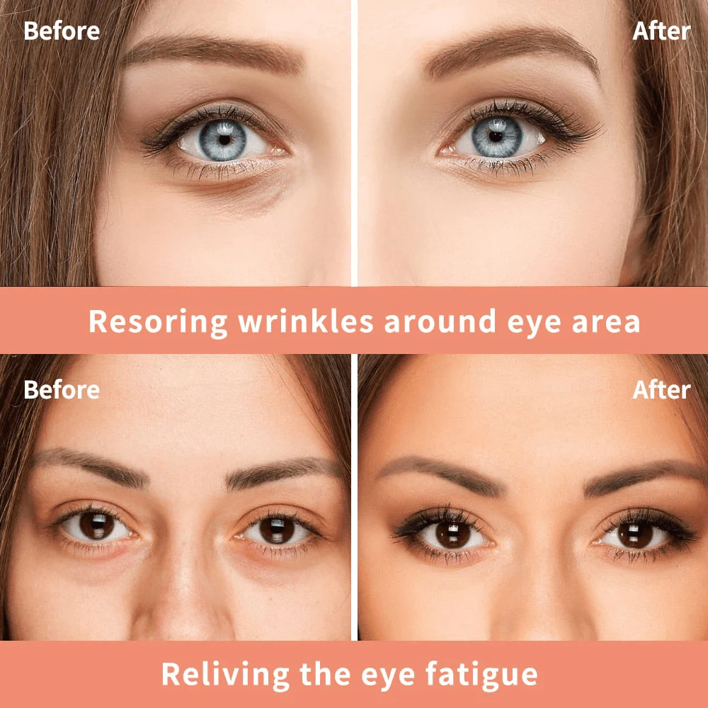 Vibrant Glamour Cayman Repair & Treatment Eye Cream - 20g - Image 5