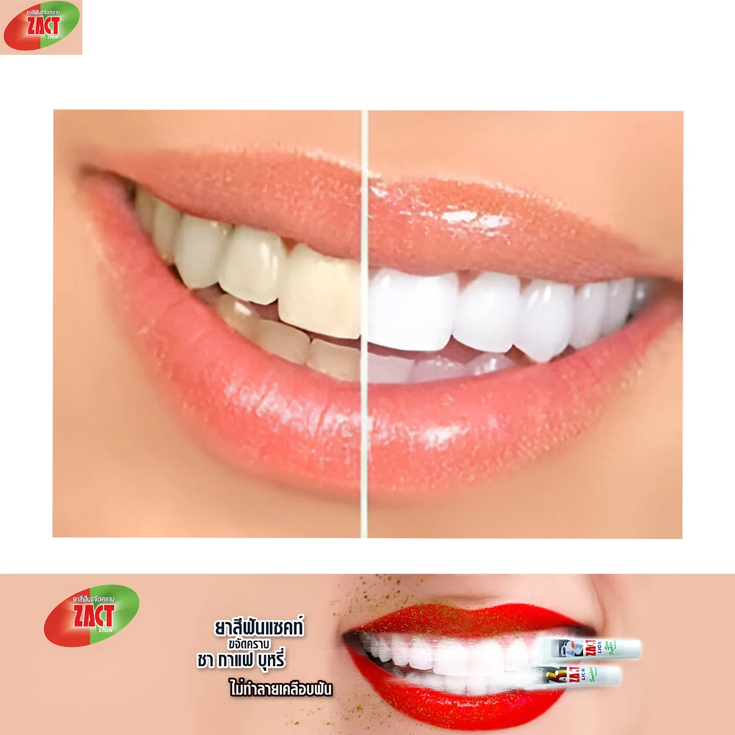Zact Lion Stain Fighter Toothpaste(Shiny White Teeth & Fresh Breath)- 160g - Image 5